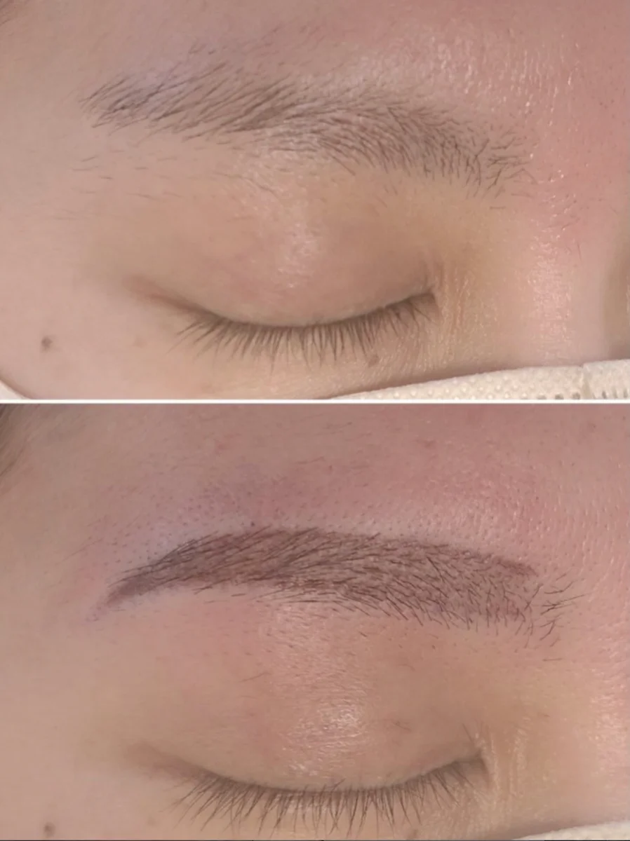 Before / After