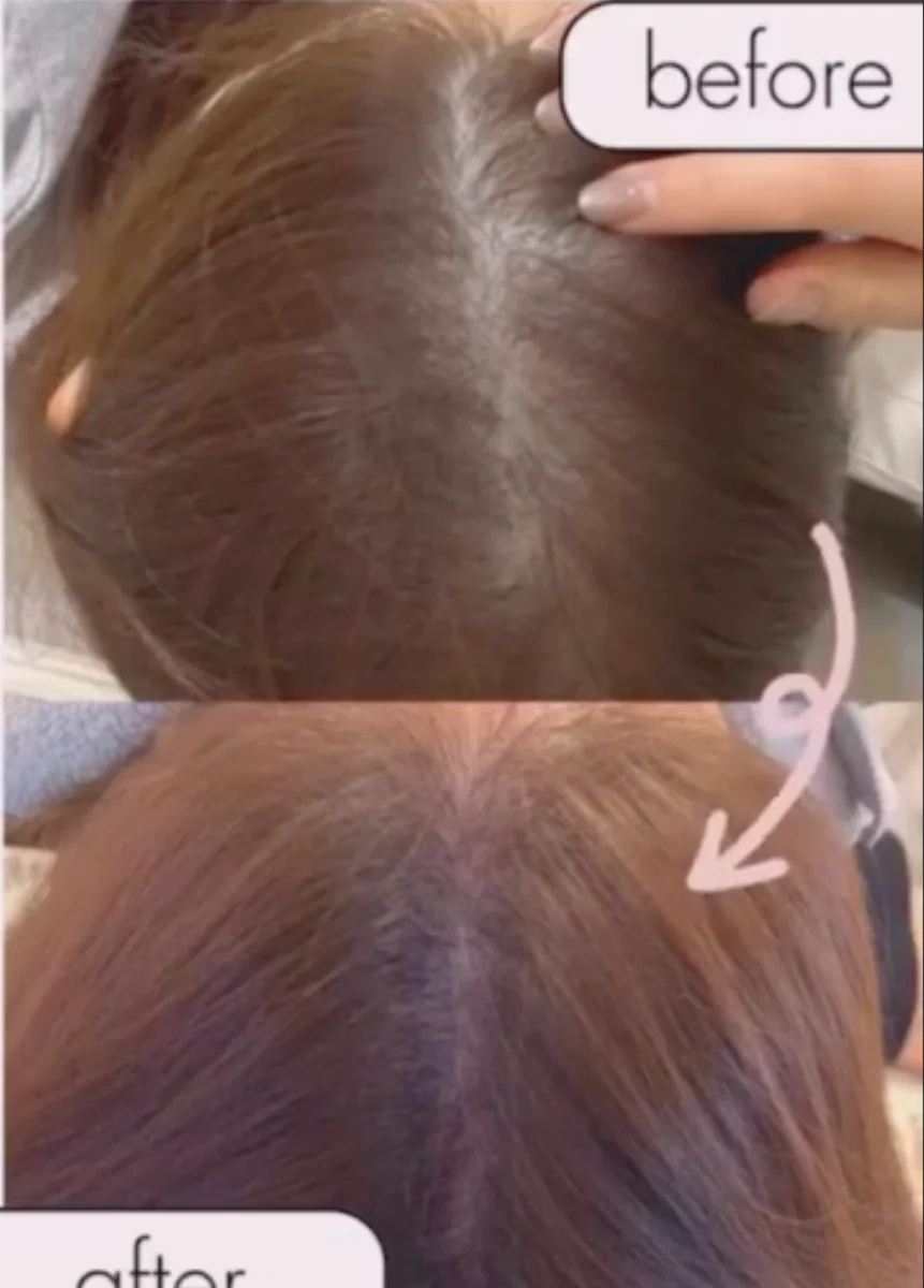 Before / After